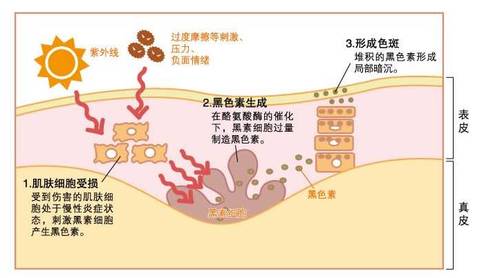 论美白产品有效成分,成分分析美白精华