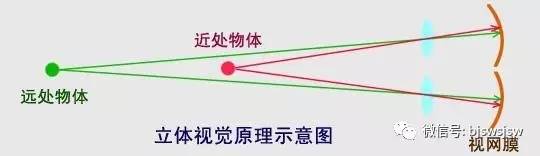 弱视无立体感怎么训练,弱视缺乏立体感