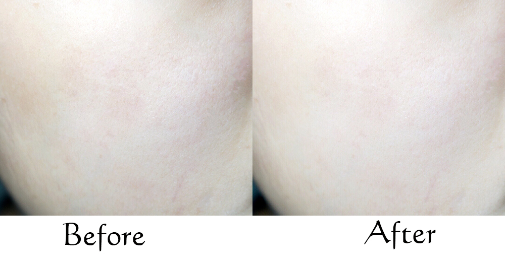 rachel护肤品怎么样,rachel夏日