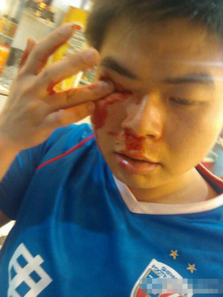 抡板凳，打城管，竖中指中超球迷*力暴**现代史