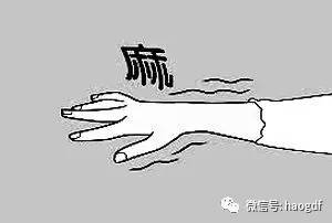 颈椎病疼痛科医生,骨科医生如何看颈椎病