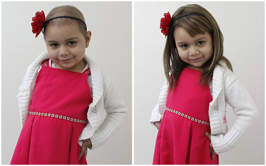 脱发白发假发定制,让人震惊的假发定制