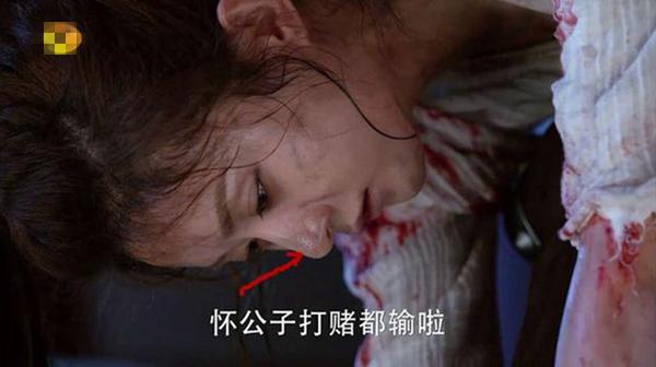 楚乔赵丽颖皮肤变差了！熬夜*党**又该怎么拯救自己的脸？真想早点这知道这些急救面膜……