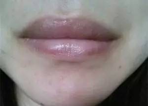 嘴唇变青、变紫、变黑,是身体出了大问题?从唇色读懂身体的秘密!