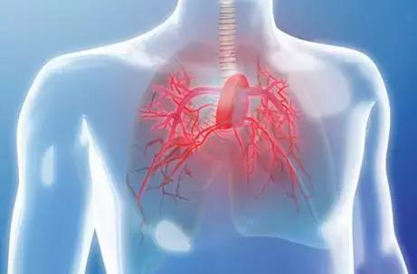 长在什么地方的痣易癌变,每一个痣都是代表疾病吗