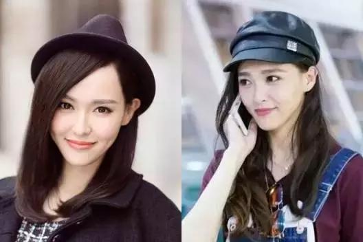 年轻人如何改善发量稀疏,发量稀少怎么补救最快最有效