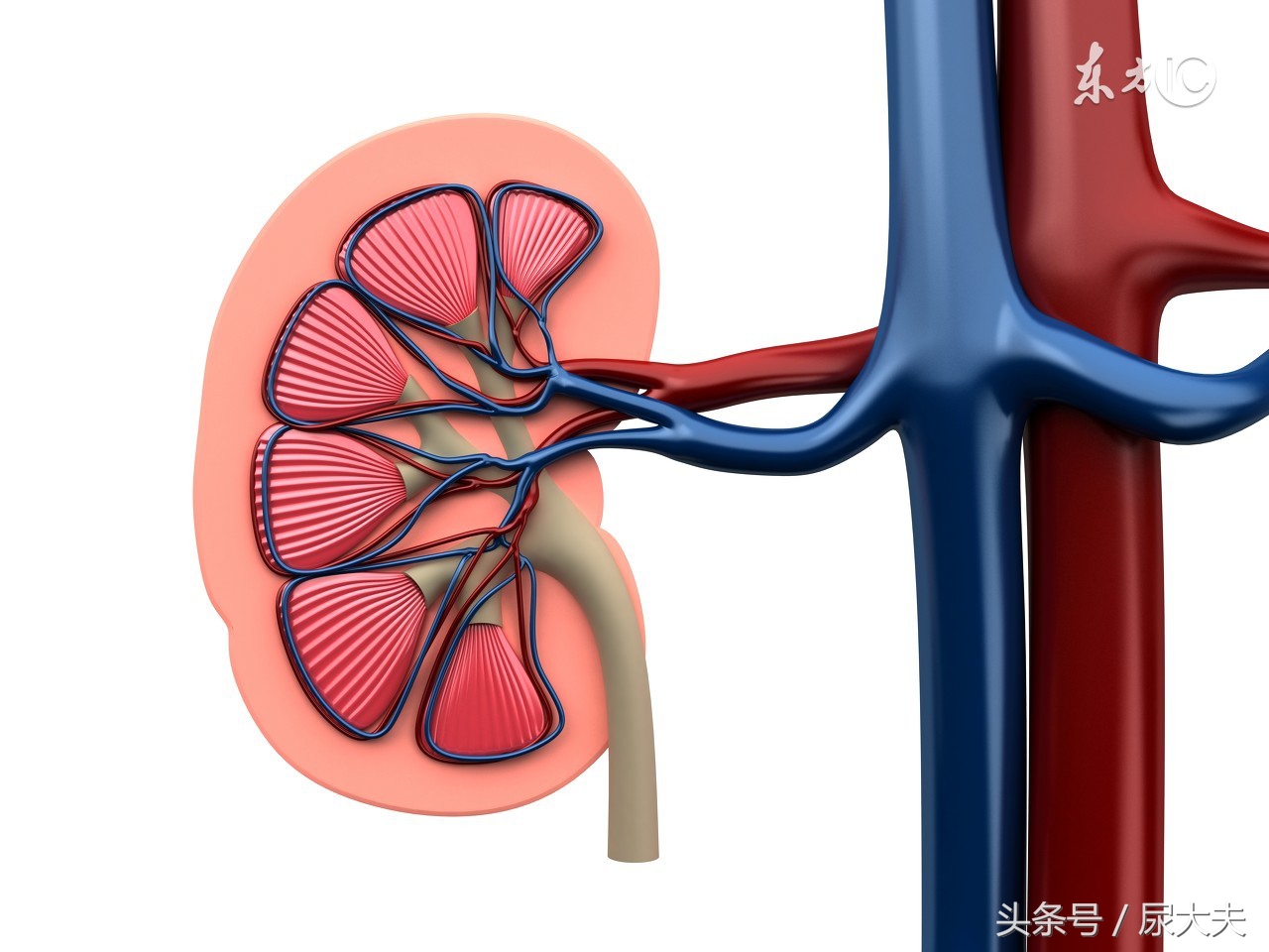 肾积水引起的腰疼快速消除方法,肾积水腰痛出现几次会加重积水