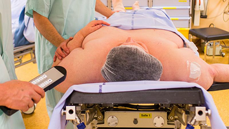 手术减肥的利弊,手术减肥副作用大吗