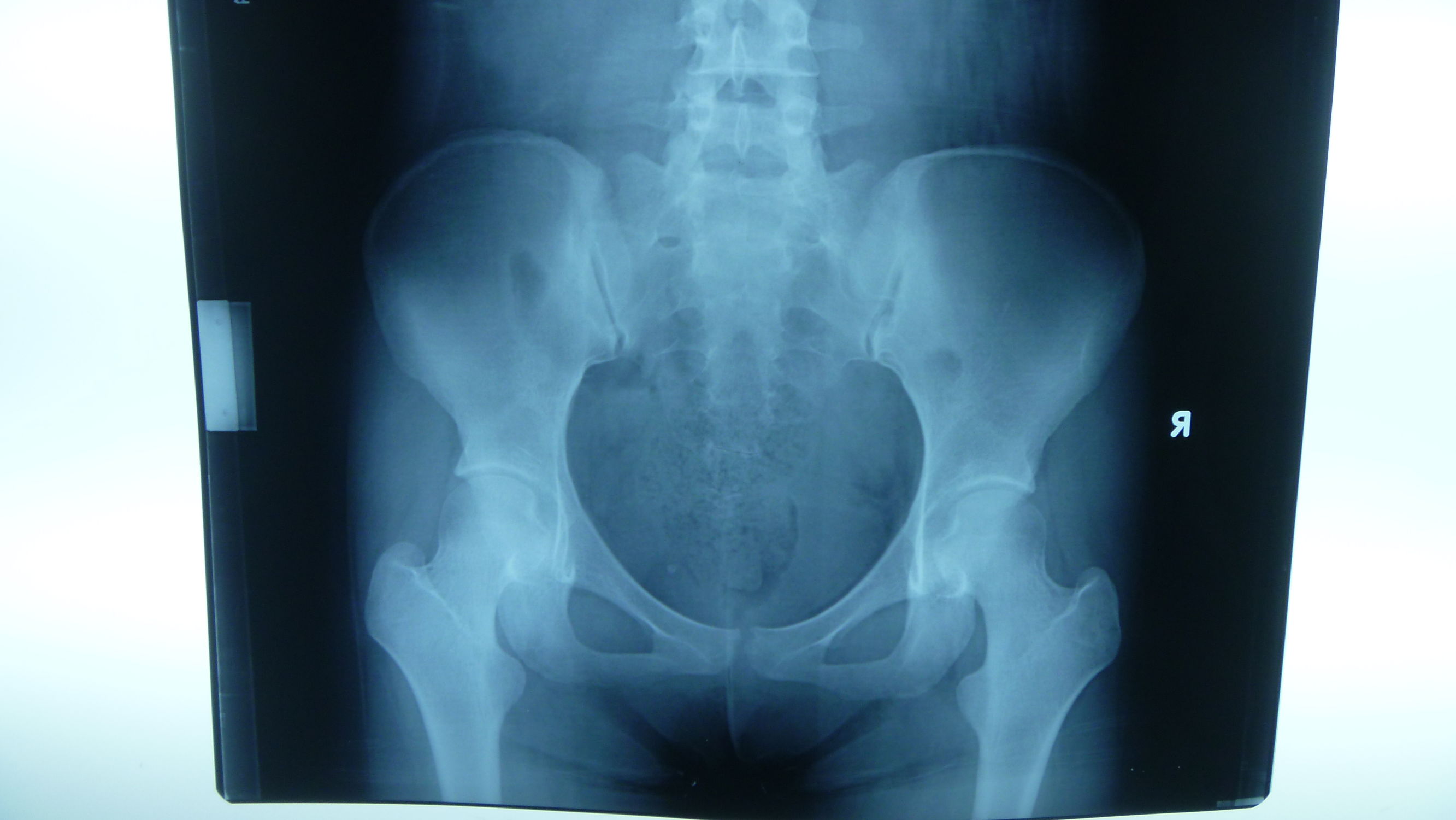 孕期准妈妈需要做什么检查,准妈妈必看孕期运动注意事项