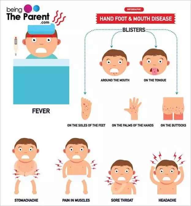手足口的防治公开课,大人手足口治疗方法及护理