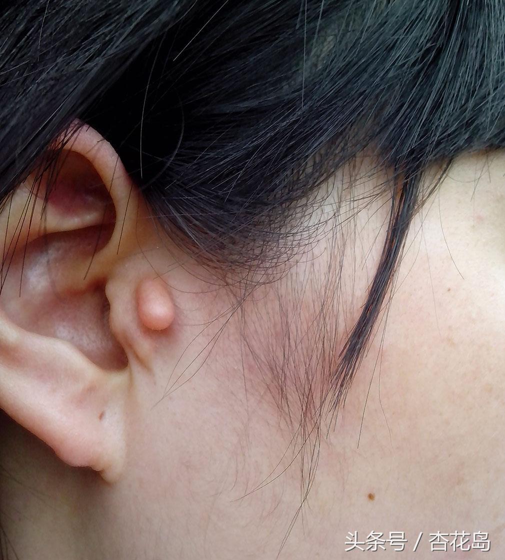 长小耳朵是怎么回事,长小耳朵什么意思