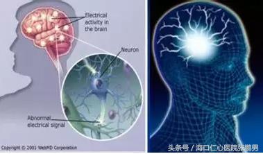 商丘地区哪有治癫痫病的民间偏方,癫痫病能医治断根吗