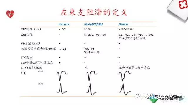 「心声」从机制到临床，一起认识左束支阻滞！