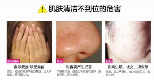 下巴痘痘反复长不停如何正确祛痘,下巴老是长痘痘怎么调理身体啊