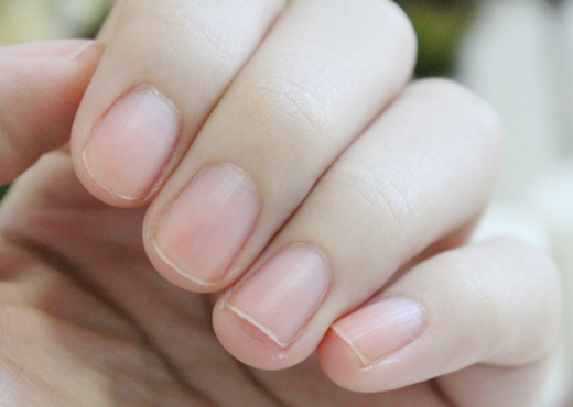 指甲旁边倒刺如何消灭,婴儿指甲旁边长倒刺