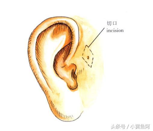 小黄鱼看病后续,小黄鱼明白了什么道理