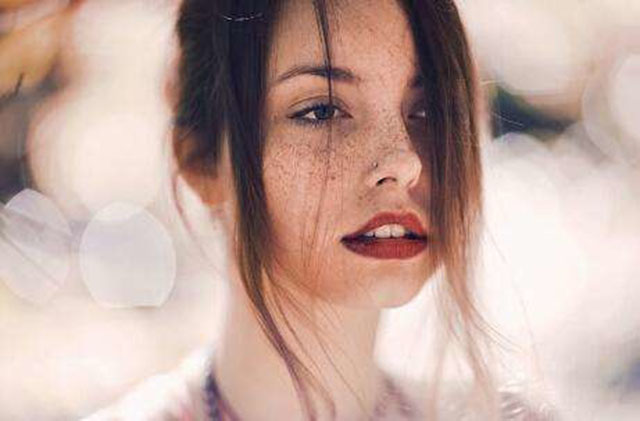 遗传雀斑激光会反弹吗,海口祛雀斑激光不反弹哪个医院好