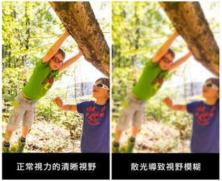 郑大夫斜弱视,郑大夫弱视事件