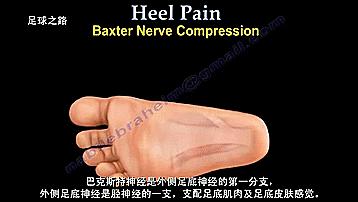 足跟痛的症状及表现,足跟痛最常见病因