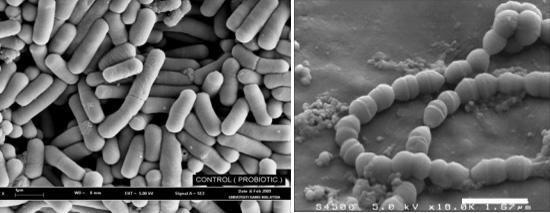 乳酸菌有线粒体还是无线粒体,乳酸菌只有酸奶有吗