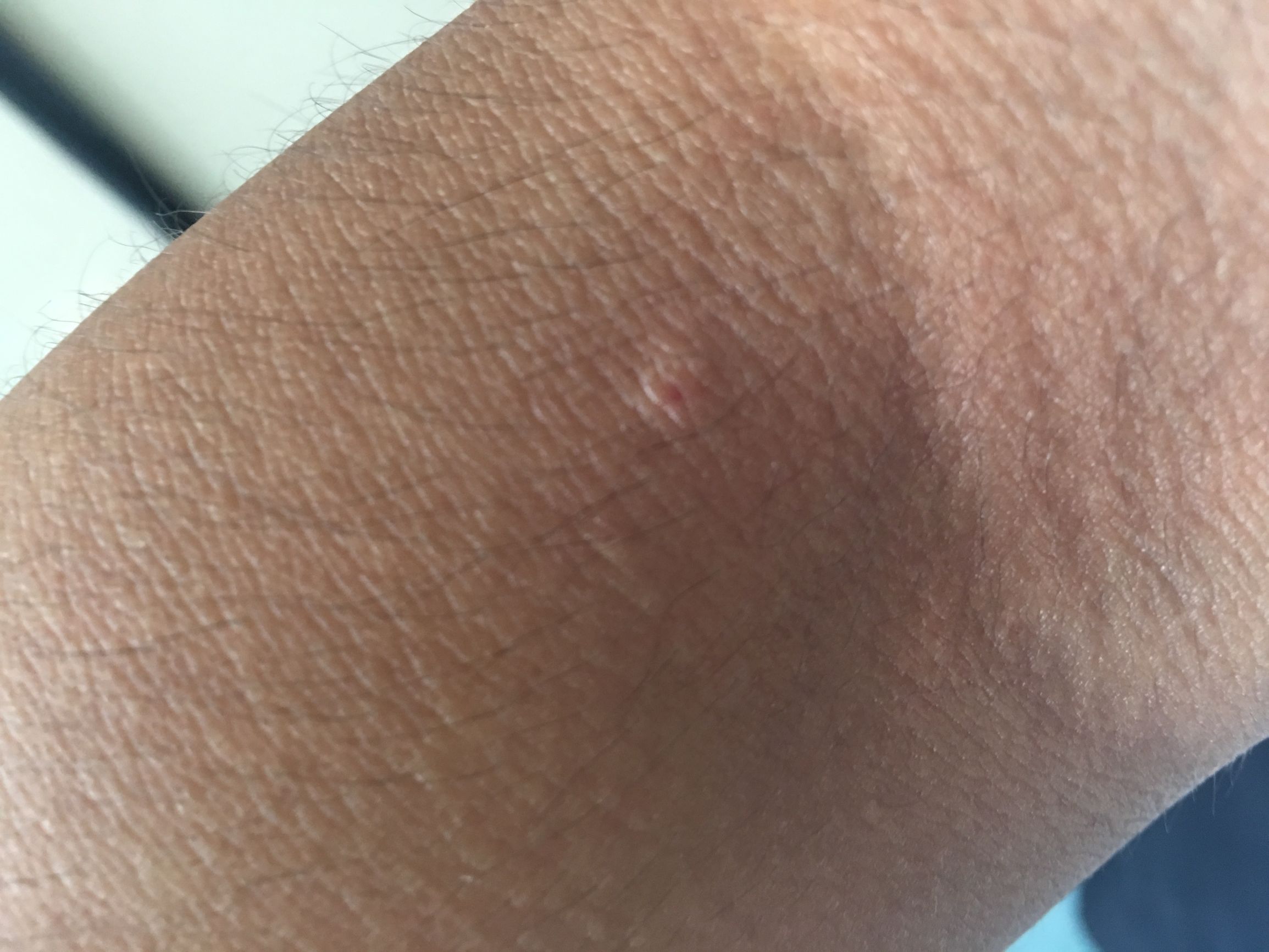 无偿献血真的可怕吗,北京市无偿献血政策