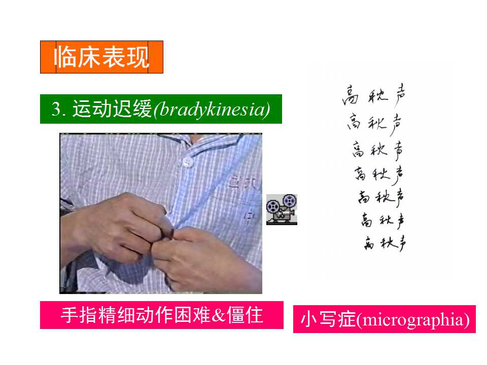 多图详解帕金森及运动障碍性疾病|关于帕金森最全的一个课件