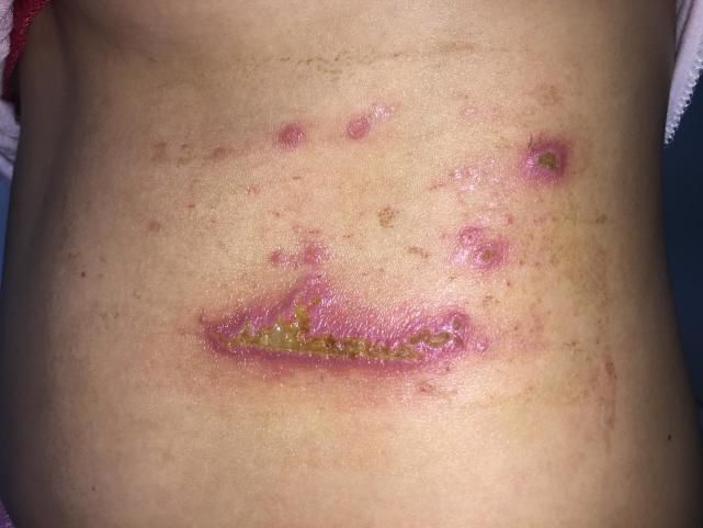 在野外见到这种虫子千万不要扔,有酸性的小虫子