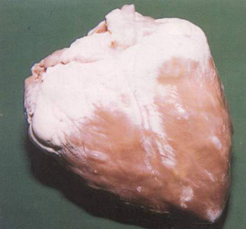 人感染猪囊虫病怎么办,人畜共患寄生虫病中的动物是什么