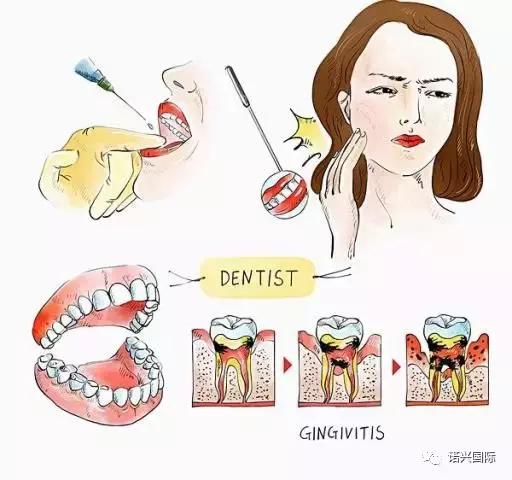 孕妇牙疼可以去看牙医么,孕妇牙疼应该如何治愈