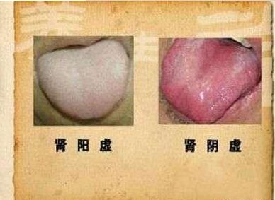阴虚阳虚阴阳两虚怎么区别,阴虚阳虚阴阳两虚都有什么表现