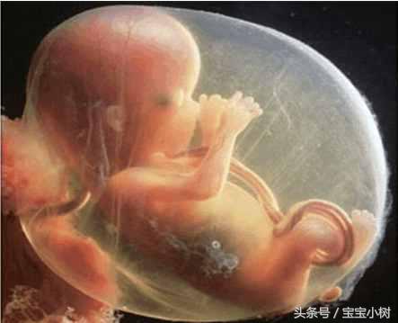 37周脐带绕颈2圈还有可能绕出来吗,如何避免胎儿脐带绕颈