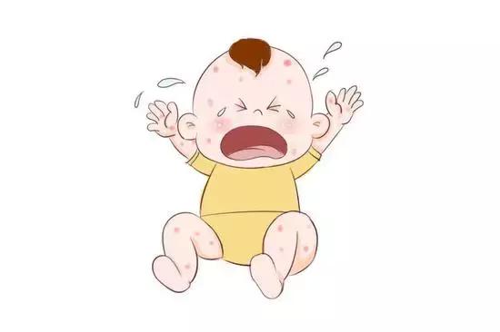 夏季痱子怎么快速去除,小孩长热痱子怎么快速消除止痒