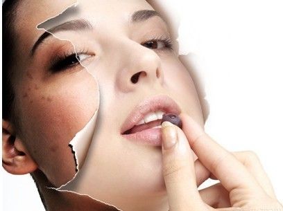 激光全身美白要多少钱,激光美白脸部前后图片