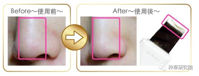 什么方法可以让皮肤嫩嫩滑滑,如何让皮肤光滑得像剥了壳的鸡蛋