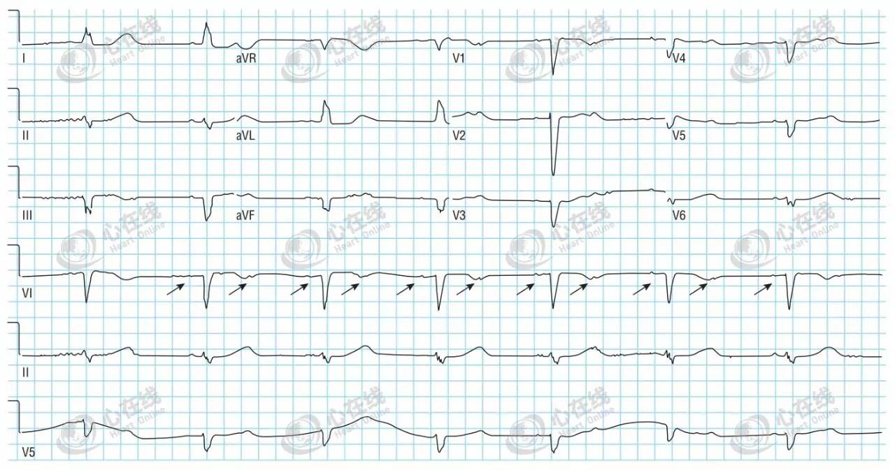 必杀技完整电影版,必杀技一招致命