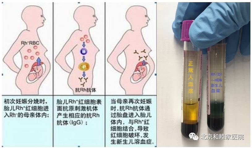 和睦家科普知识,和睦家长