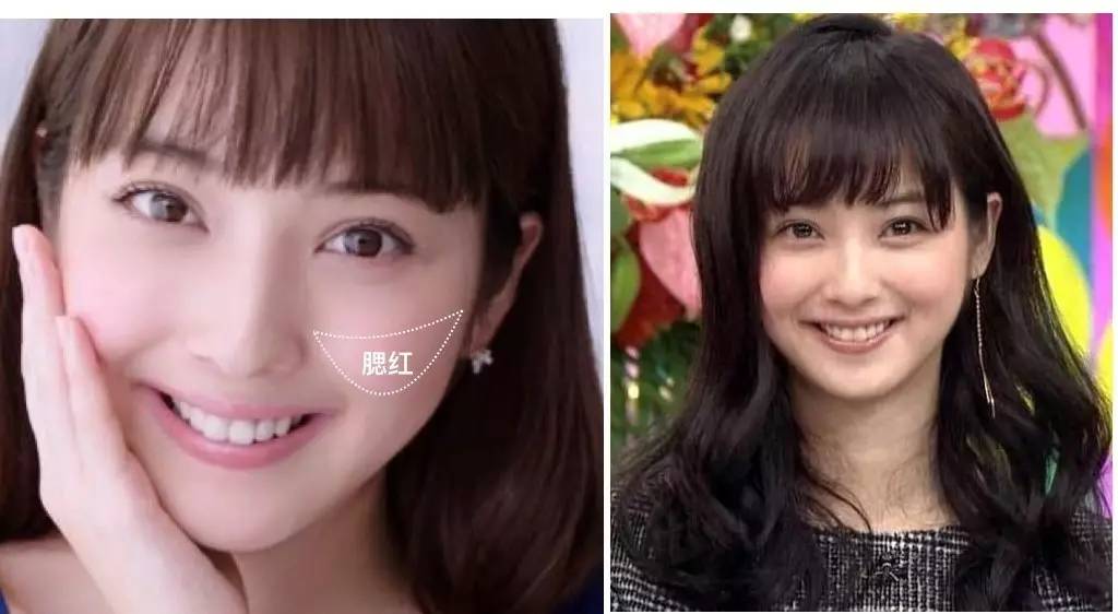 泪沟法令纹颈纹显老怎么办,改善泪沟法令纹全脸提升的方法