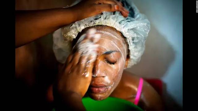 “我想变白，这样就会有更多男人来追我”