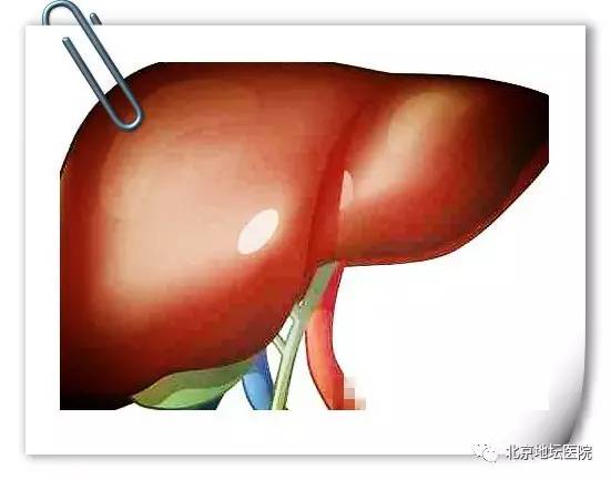 肝血管瘤良性用切除吗,微创治疗肝钙化灶