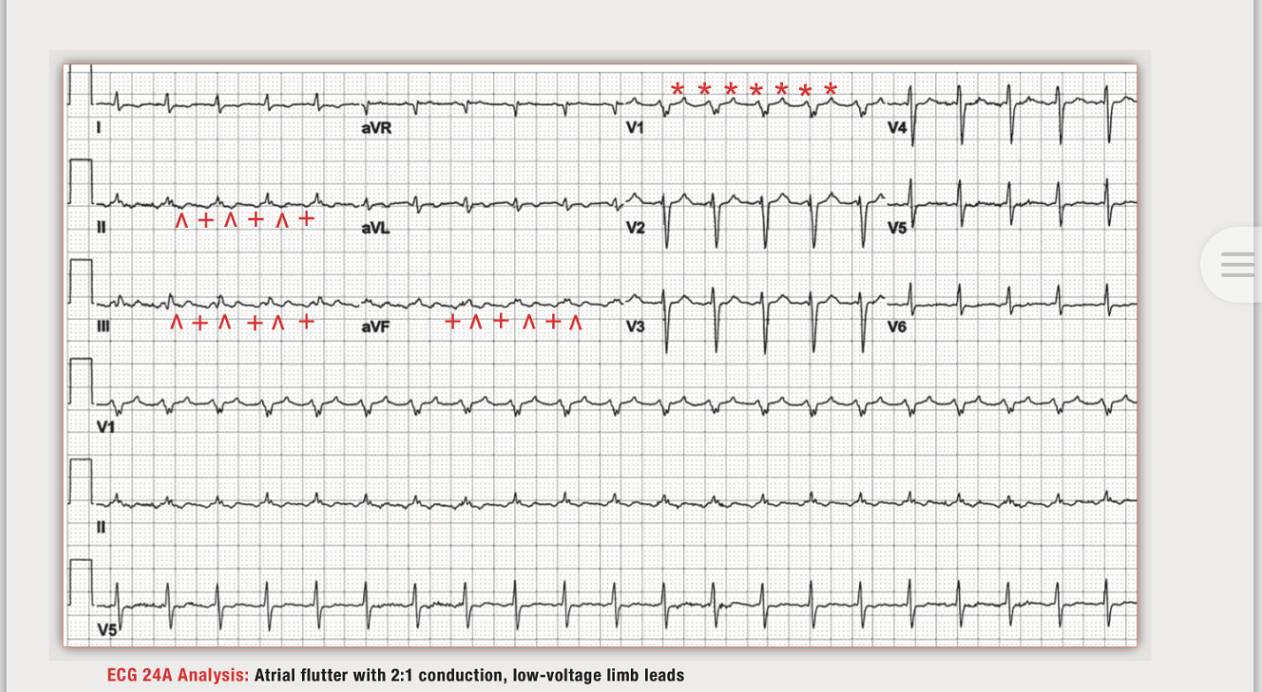 「读心有术」168期：房扑也能文氏传导，你听说过吗？
