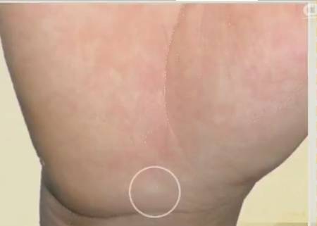 手上发红发紫是怎么回事,手部发青要警惕