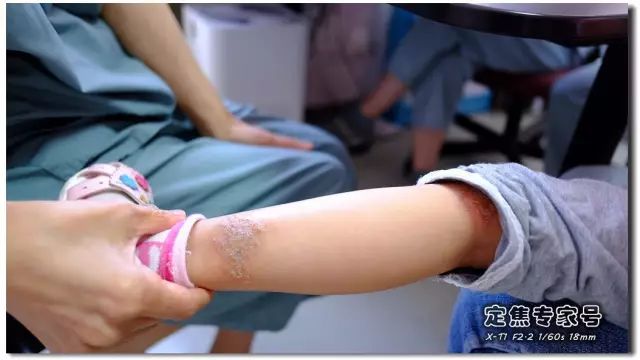 「热点」越是古老的疾病坑越多,一个湿疹能有多少坑把父母掉进去?