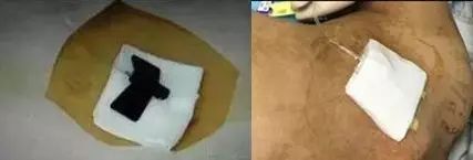 杈撴恫娓澏褰㈤拡绌垮埡瑙嗛,铦剁考閽堝埡鍏ヨ緭娑叉腐鎿嶄綔娴佺▼