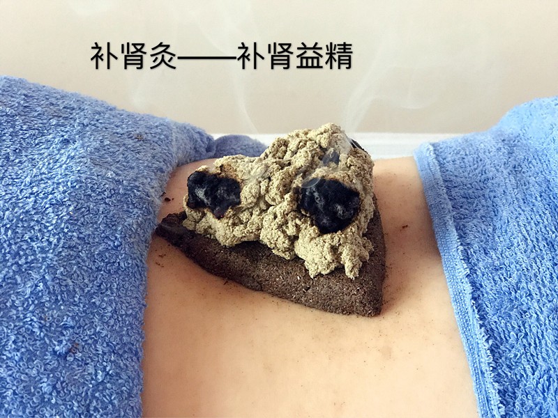 一叶知秋，雪中送炭话艾灸