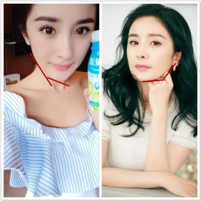 重度下垂的脸怎么恢复,已经下垂的脸还可以拯救吗