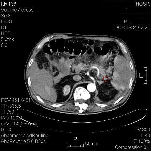 为什么腹痛会引起面色苍白,腹痛未明确原因可以输液吗