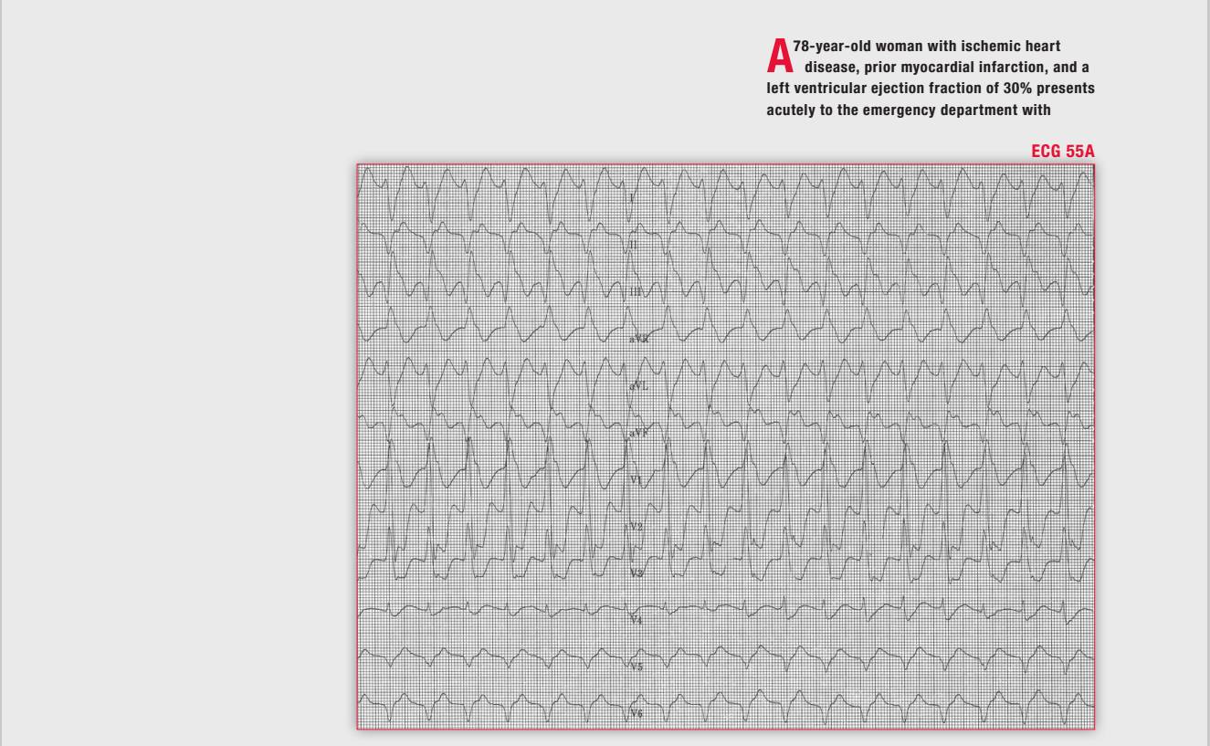 读心有术150期,读心术169