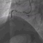 典型病例及处理方法,典型病例分析及治疗方法