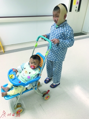 七上手术台“补脸”他可以闭眼睡觉了