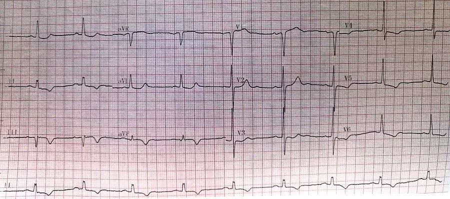 典型病例及处理方法,典型病例分析及治疗方法
